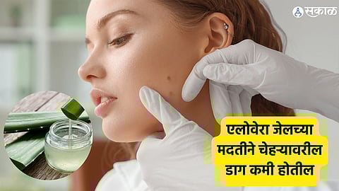 Aloe vera gel Skincare tips