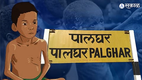Palgar : मुंबईपासून हाकेच्या अंतरावर असूनही जिल्ह्यात कुपोषित बालकांची संख्या हजाराच्या वर