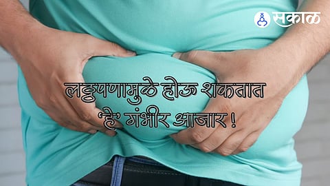 Obesity: शंभरात १२ मुलांमध्ये आढळतो लठ्ठपणा ! लठ्ठपणात 'या' गंभीर आजारांची पाळेमुळे, तज्ञांनी दिली माहिती