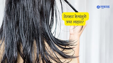 Oily and Greasy Hair Problems