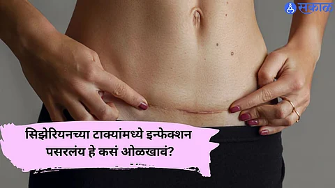 Women Health Tips
