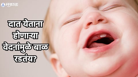 Babies Teething: दात येताना होणाऱ्या वेदनांमुळे बाळ रडतंय? मग हे उपाय देतील चुटकीसरशी आराम! 