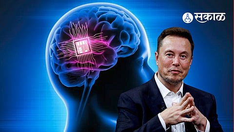 Brain Chip Implant Neuralink Elon Musk