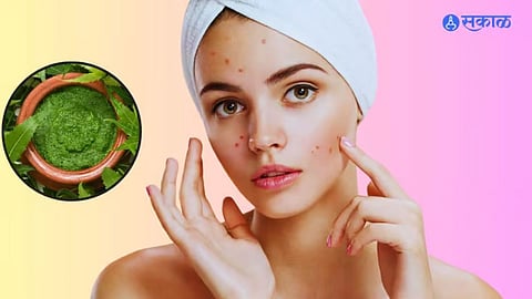 Skin Care Tips