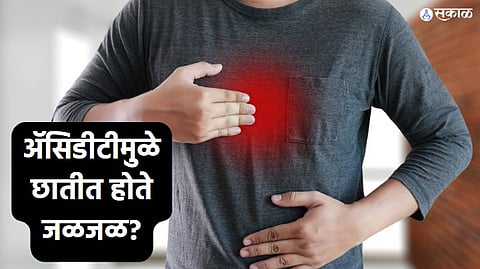 Health Care News : ॲसिडीटीमुळे छातीत होते जळजळ? मग ‘या’ 4 स्पेशल हेल्दी ड्रिंक नक्की ट्राय करा