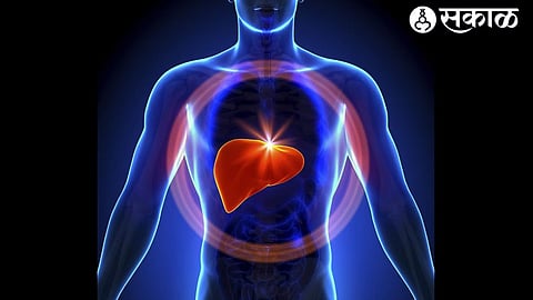 Fatty liver Disease : फॅटी लिव्हरचे 35 टक्के नागरिक शिकार..! जीवनशैलीतील बदल कारणीभूत
