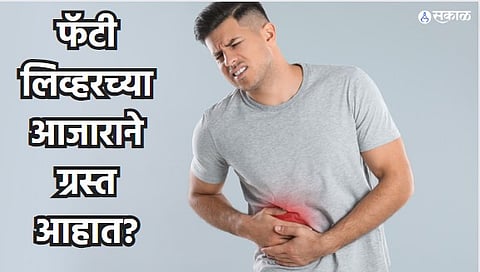 Health Care News : फॅटी लिव्हरच्या आजाराने ग्रस्त आहात? मग हे सोपे उपाय ठरतील फायदेशीर