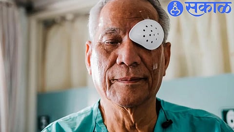 cataract surgery ( file photo )