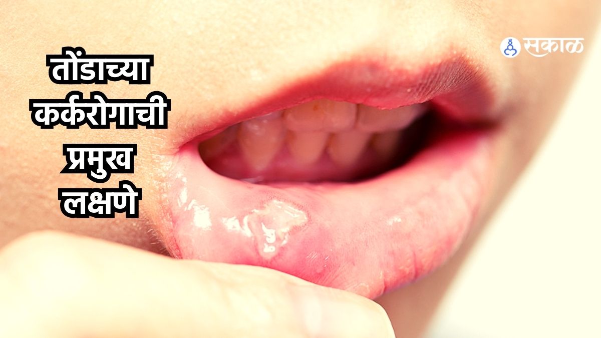 World Cancer Day 2024