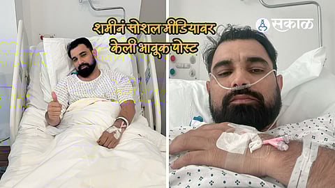 Mohammed Shami Surgery Updates