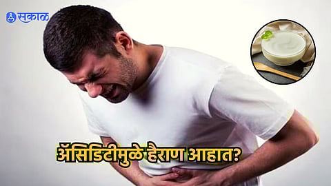 Home Remedies for Acidity