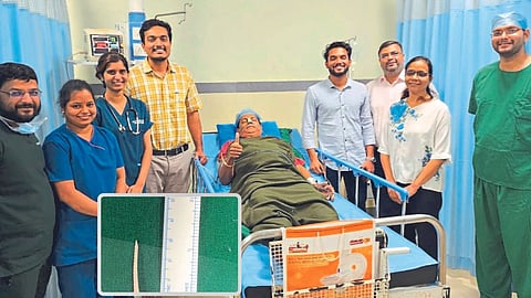 Fish Bone Stuck in Throat