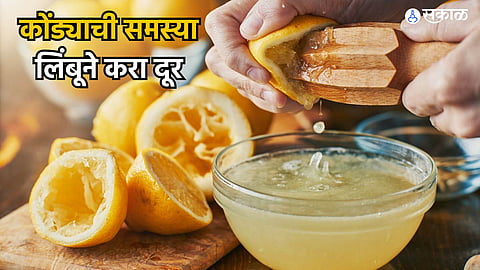 Hair Care Tips : कोंड्याची समस्या कमी करण्यासाठी लिंबाच्या सालींचा अशा प्रकारे वापर करा, जाणून घ्या 