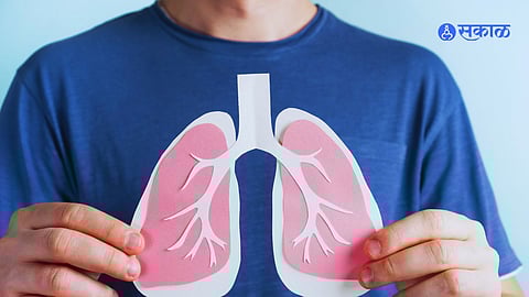 Tuberculosis Disease