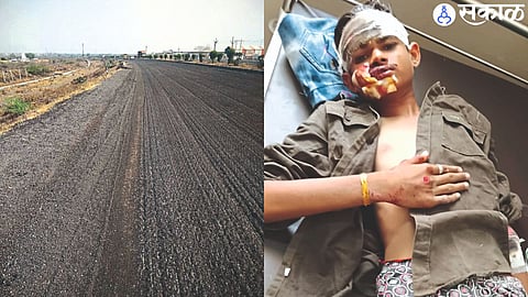 Mumbai-Agra Highway dug between Songir to Babhale Phata. In the second photo, the injured youth.