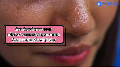 Oily Skin Care