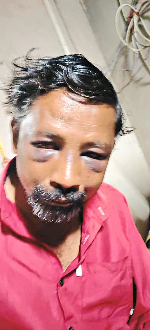 खासगी सावकारीतून नागावच्या तरुणास बेदम मारहाण