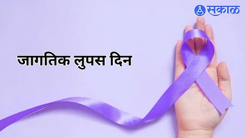 World Lupas Day 2024