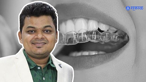 Success Story: डॉ. विवेक चिट्टे यांची दंतवैद्यक क्षेत्रात नवी क्रांती, महाग ठरणाऱ्या उत्पादनाला हा नवा पर्याय