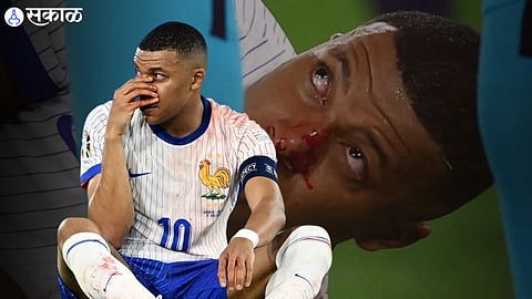 Kylian Mbappe