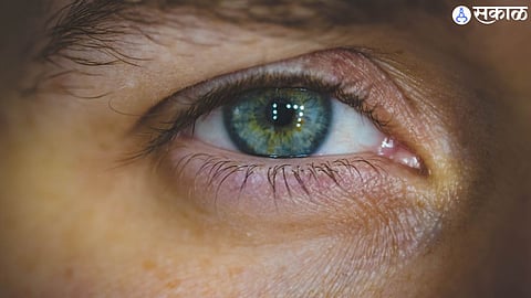 World Eye Donation Day 2024