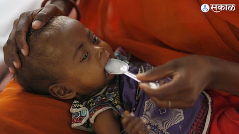 number of malnourished children reduced in 2 months