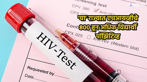 HIV