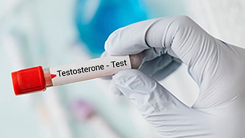 Testosterone tests