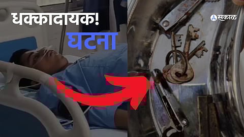 Doctors performing surgery to remove metal objects from a 22-year-old man's stomach