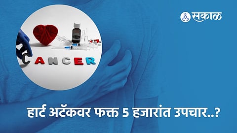 Heart Attack | Viral Video