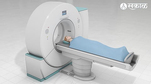 CT Scan