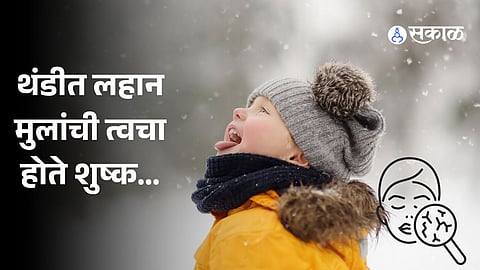 Winter Child Skin and Hair Care: