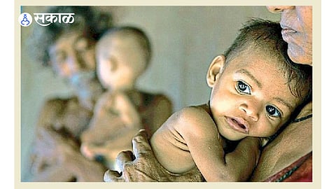 Malnourished Children