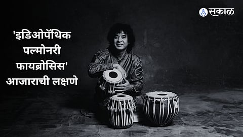 Ustad Zakir Hussain passes away from idiopathic pulmonary fibrosis