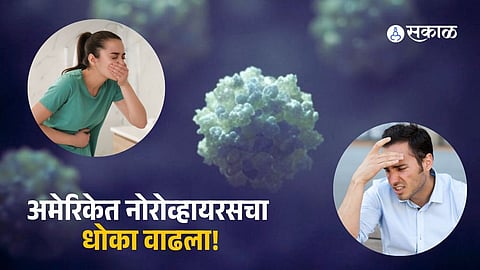 Norovirus Outbreak In America