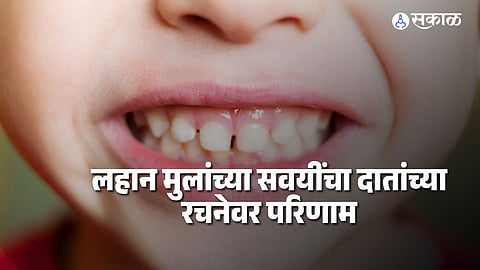 Children's dental habits: