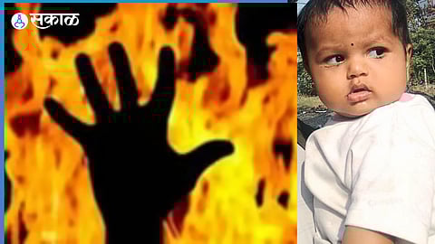 The heart-wrenching story of an eight-month-old baby who fought for life for nine days after falling into a fireplace, tragically passing away from the injuries.