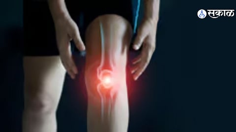 Cold weather exacerbates joint pain and can affect recovery after joint replacement surgery.