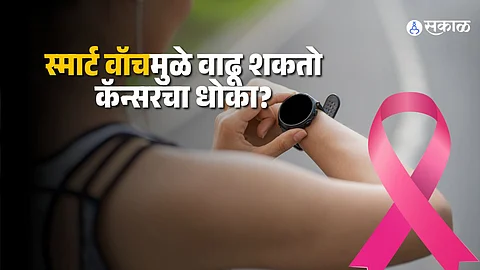 Smart Watch: