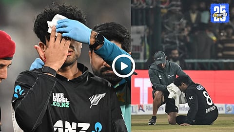 RACHIN RAVINDRA INJURY