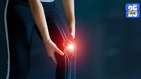 Arthritis