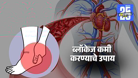 Morning Leg Symptoms: