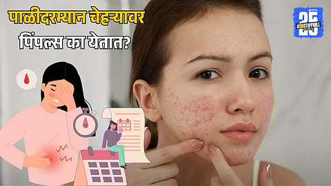 Skincare During Period