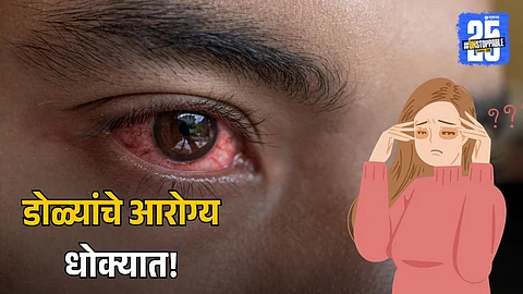 Eye Dryness and Irritation