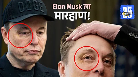 Elon Musk shows visible bruising under his eye at his final White House appearance, reveals son X accidentally punched him while playing