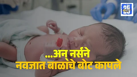Nurse Cuts Baby Finger