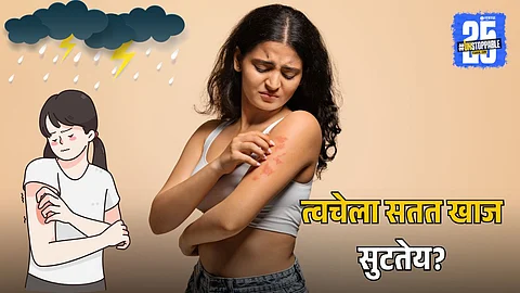 Monsoon Skin Care Tips: पावसाळ्यात त्वचेला सतत खाज सुटतेय? मग घरच्या 'या' पॅकचा वापर करा आणि मिळवा नैसर्गिक आराम!