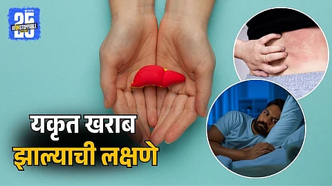 Night Signs of Liver Damage