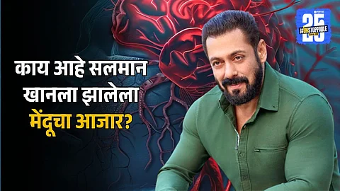 What is Arteriovenous Malformation |Salman Khan