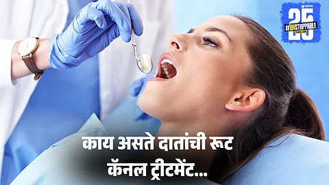 root canal procedure, d